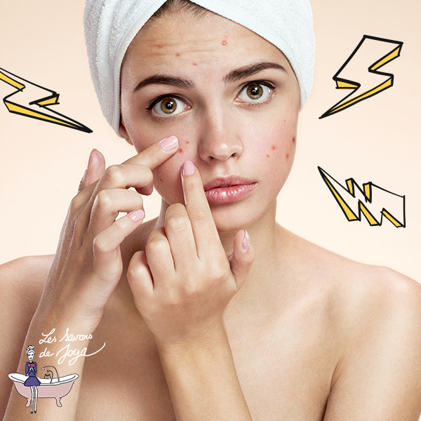 L'acné hormonale : comment la soulager naturellement ?