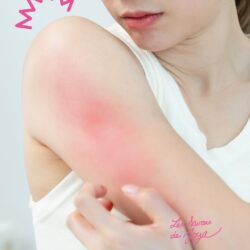 Peau qui gratte après la douche en hiver : causes et solutions naturelles