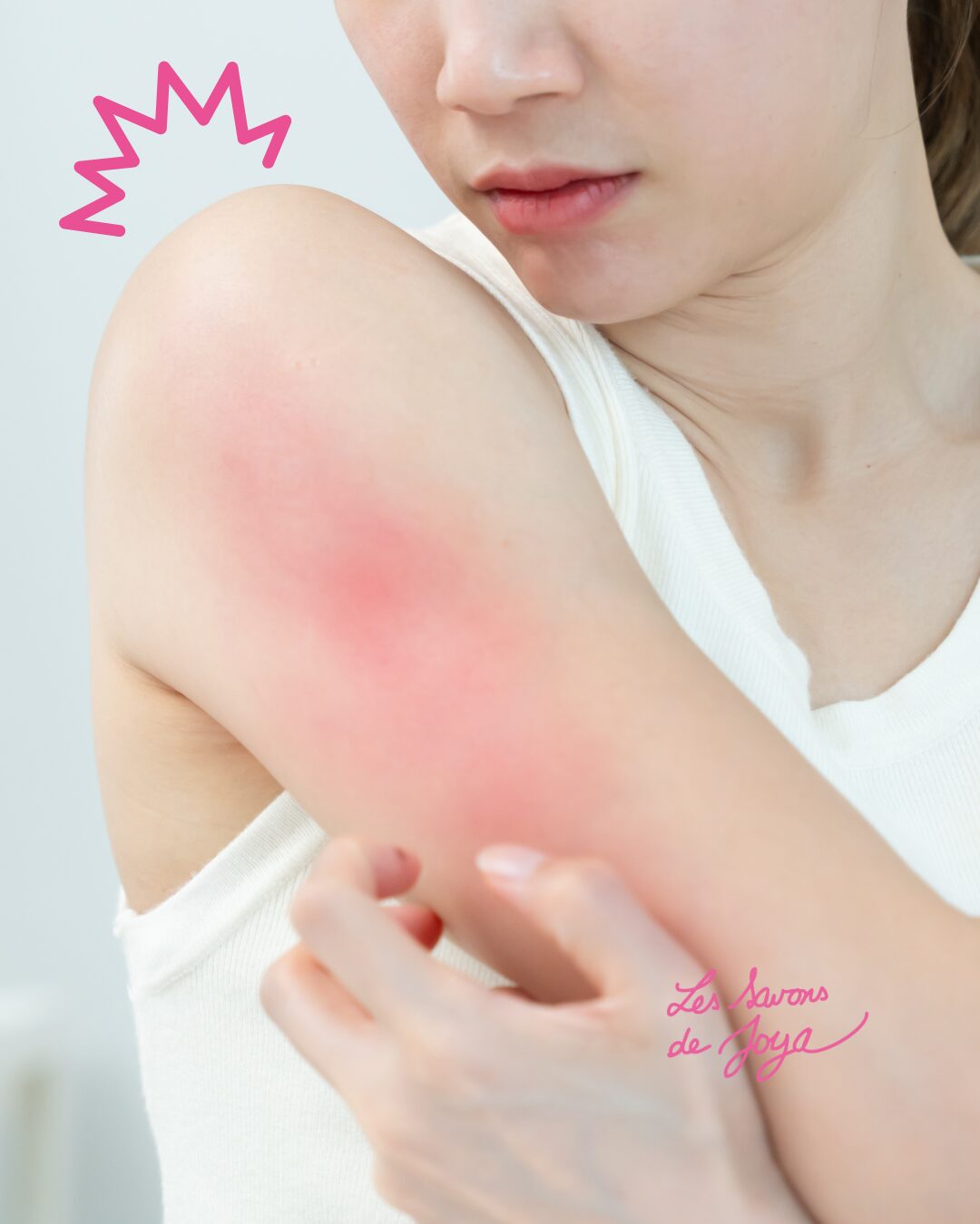 Peau qui gratte après la douche en hiver : causes et solutions naturelles