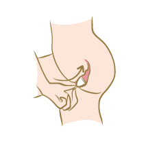 <p>Maintenez bien par sa base votre cup menstruelle bio ainsi pliée et insérez-la dans le vagin en la faisant tourner dans un sens puis dans l'autre. Une coupe bien à sa place doit tourner facilement. Une coupelle menstruelle se porte plus bas qu'un tampon hygiénique placé, lui, à l'entrée du col de l'utérus. La cup s'insère plus bas, près de l'entrée du vagin. Pour savoir si elle est placée à bonne hauteur, vous devez pouvoir la toucher en insérant seulement une phalange dans votre vagin. En cas de difficulté mettez un peu de lubrifiant à l'entrée du vagin ou placez votre coupelle mensuelle bio sous l'eau tiède.<br />Une fois mise en place la cup adhère naturellement aux parois du vagin. Vous ne devez pas la sentir. Si tel n'est pas le cas, c'est qu'elle est mal positionnée.<br /><br /></p>