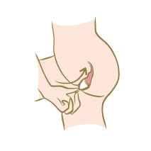 Maintenez bien par sa base votre cup menstruelle bio ainsi pliée et insérez-la dans le vagin en la faisant tourner dans un sens puis dans l'autre. Une coupe bien à sa place doit tourner facilement. Une coupelle menstruelle se porte plus bas qu'un tampon hygiénique placé, lui, à l'entrée du col de l'utérus. La cup s'insère plus bas, près de l'entrée du vagin. Pour savoir si elle est placée à bonne hauteur, vous devez pouvoir la toucher en insérant seulement une phalange dans votre vagin. En cas de difficulté mettez un peu de lubrifiant à l'entrée du vagin ou placez votre coupelle mensuelle bio sous l'eau tiède.Une fois mise en place la cup adhère naturellement aux parois du vagin. Vous ne devez pas la sentir. Si tel n'est pas le cas, c'est qu'elle est mal positionnée.